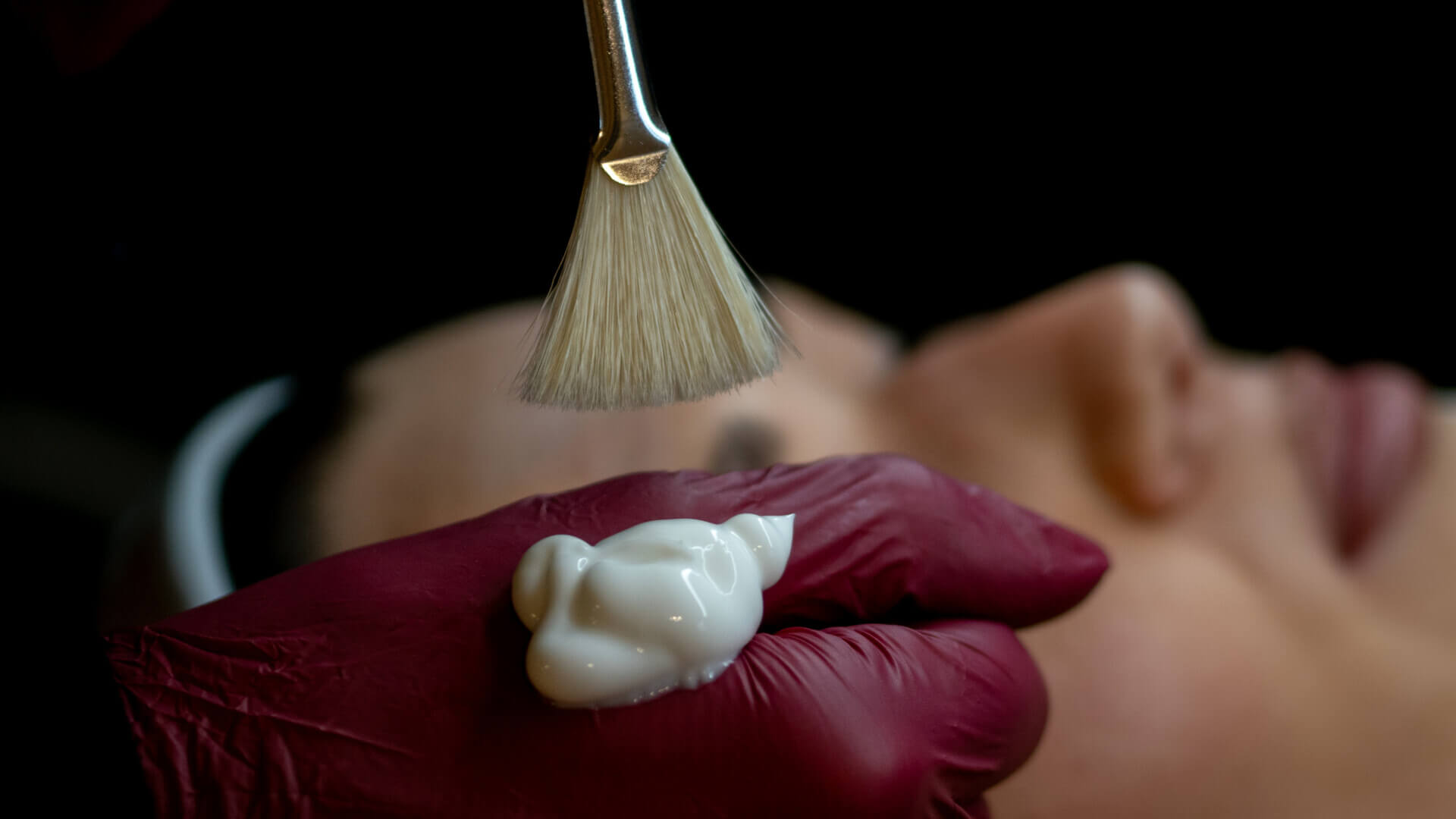 Behandeling pigmentvlekken