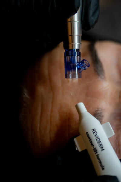 Anti-aging # Indicaties